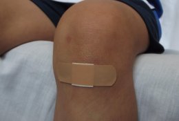 Maža žaizda – didelė rizika: kodėl stabligė vis dar pavojinga ir kada būt ...