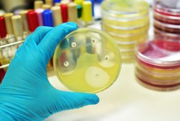 Antibiotikų poveikis vis sunkiau prognozuojamas