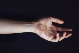 Ką tepti ant žaizdų: netinkamai pasirenkamos dezinfekcinės priemonės kelia pavojų sveikatai