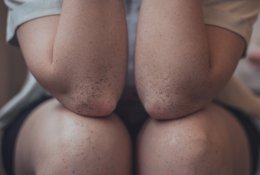 Sąnariai traška ir vyresniems, ir jauniems – kada kreiptis į medikus, o kada pakanka vizito pas vaistininką?