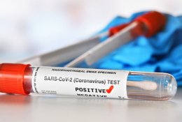 A. Širinskienė abejoja mokamų COVID-19 testų teisėtumu: kreipėsi į Europos komisiją