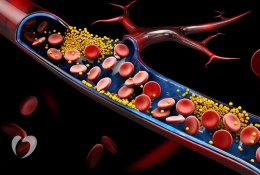 5 patarimai, kurie padės sumažinti padidėjusį cholesterolį