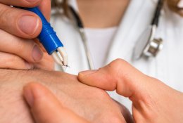 Gydytoja pataria, ką daryti įsisiurbus erkei: kaip tinkamai ją ištraukti ir kada kreiptis į gydytojus?