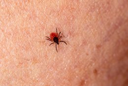 Laimo liga: kodėl neverta tikrintis iškart po erkės įkandimo?