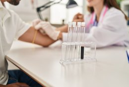 „Gerasis“ ir „blogasis“ cholesterolis: kuo jie skiriasi ir kodėl abiejų rodikliai vienodai svarbūs