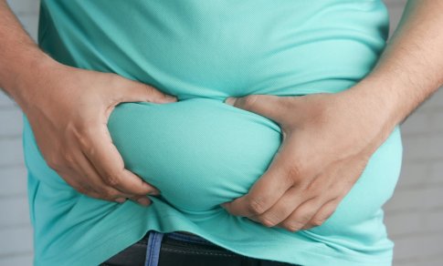 Antsvorio ir nutukimo dilema: tik estetinė problema ar rimtas pavojus sveikatai?