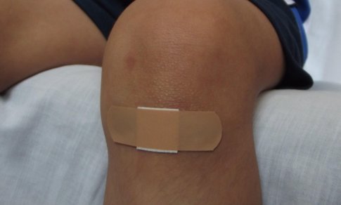 ​​Maža žaizda – didelė rizika: kodėl stabligė vis dar pavojinga ir kada būtina skubėti pas gydytoją?