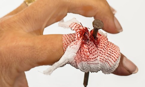 Net nedidelė žaizda gali tapti vartais į infekciją: ką svarbu žinoti apie stabligę