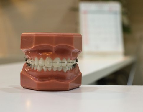 Rekordas: ištraukto ilgiausio žmogaus danties ilgis – 37,2 mm