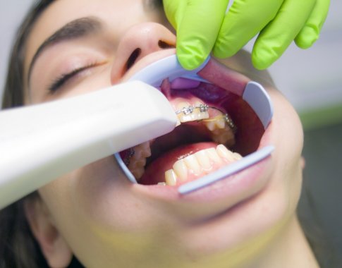 Gydytoja ortodontė: žmonės vengia breketų ir kapų dėl informacijos stygiaus