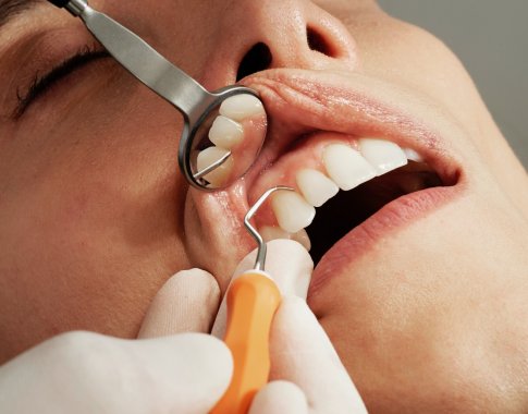 Kraujuojančios dantenos: negydant galima prarasti dantis