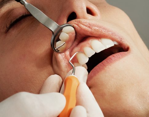 Gydytoja odontologė – apie dantų implantaciją: platesnė šypsena gali atnešti teigiamų pokyčių gyvenime Gydytoja odontologė – apie dantų implantaciją: platesnė šypsena gali atnešti teigiamų pokyčių gyvenime