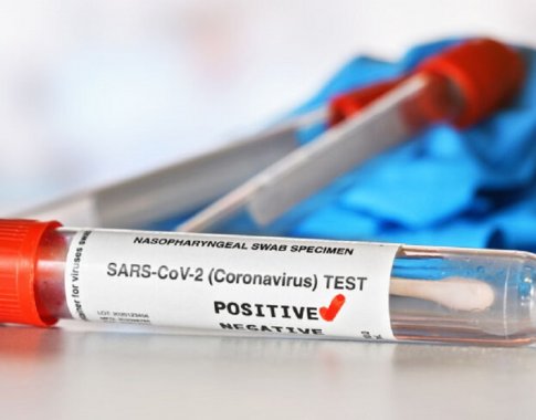 A. Širinskienė abejoja mokamų COVID-19 testų teisėtumu: kreipėsi į Europos komisiją