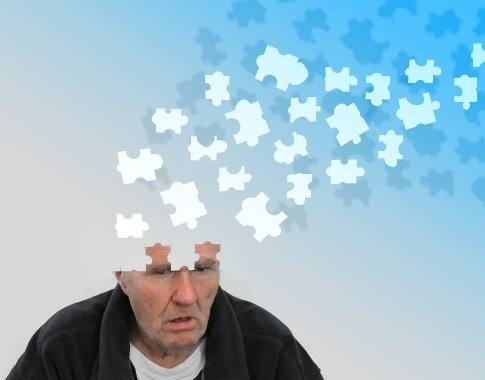 Atrastas vaistas, galintis sukelti proveržį stabdant Alzheimerio ligos progresą