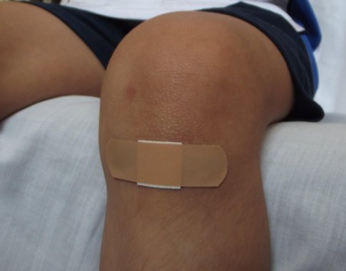 ​​Maža žaizda – didelė rizika: kodėl stabligė vis dar pavojinga ir kada būtina skubėti pas gydytoją?