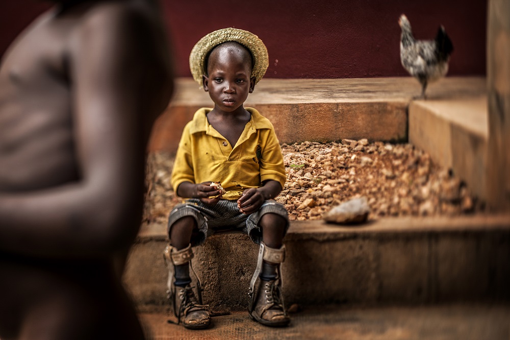 Pamatykite: UNICEF Metų nuotraukoje - berniukas iš Togo