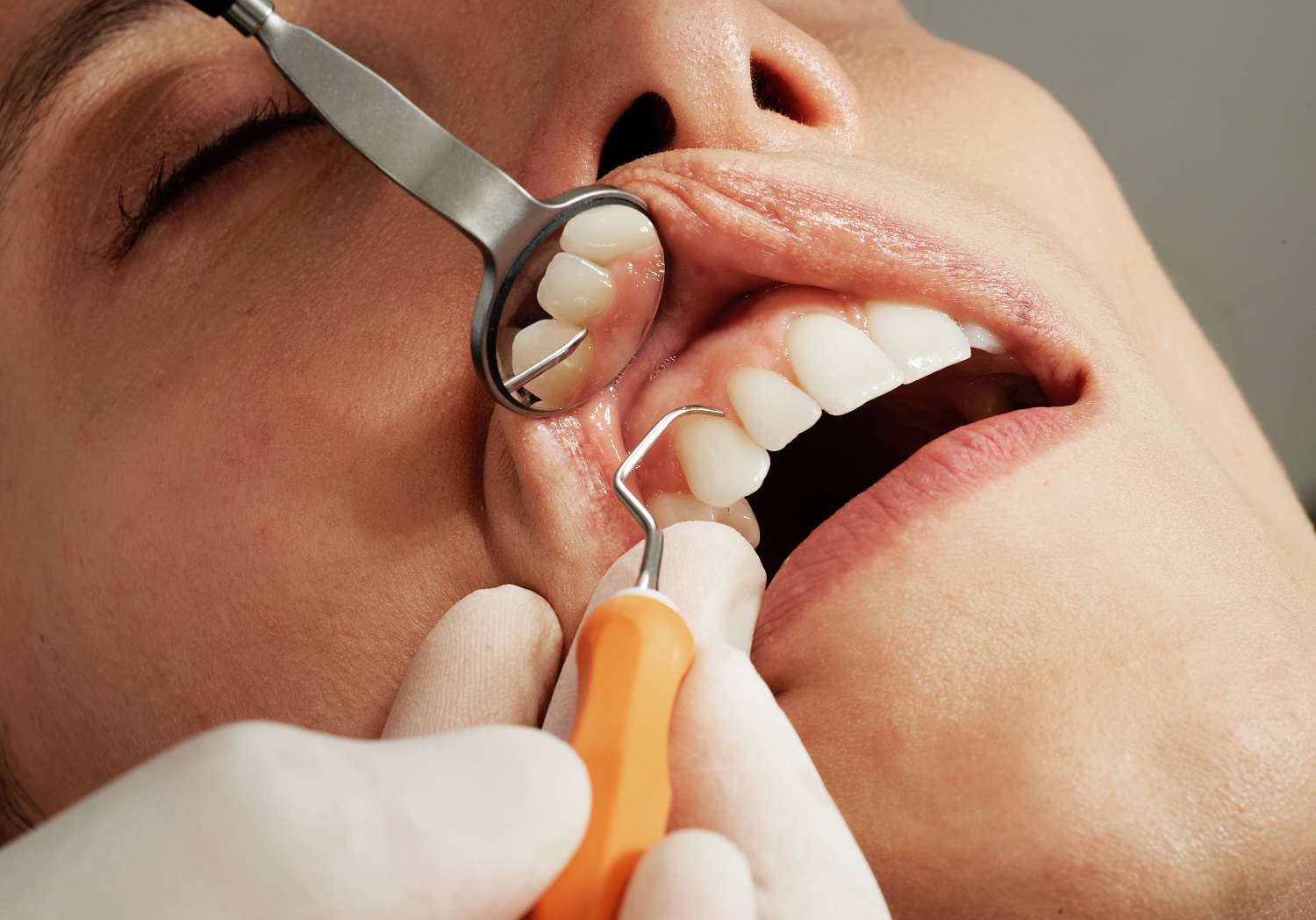 Gydytoja odontologė – apie dantų implantaciją: platesnė šypsena gali atnešti teigiamų pokyčių gyvenime