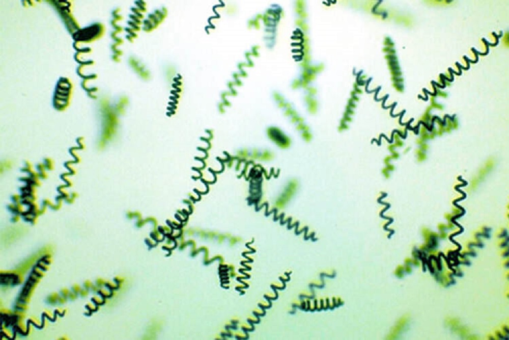 Naujai atrastas aukso grynuolis mityboje – mikrodumbliai